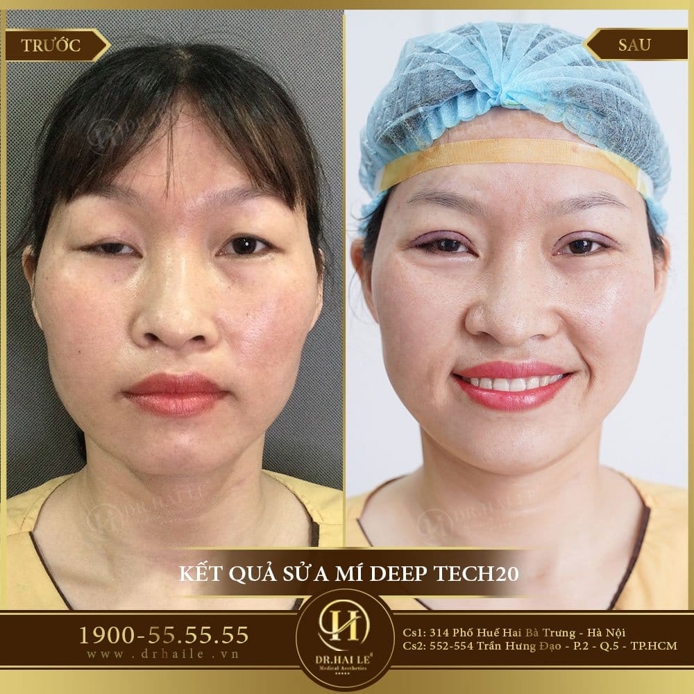 Dịch vụ cao cấp