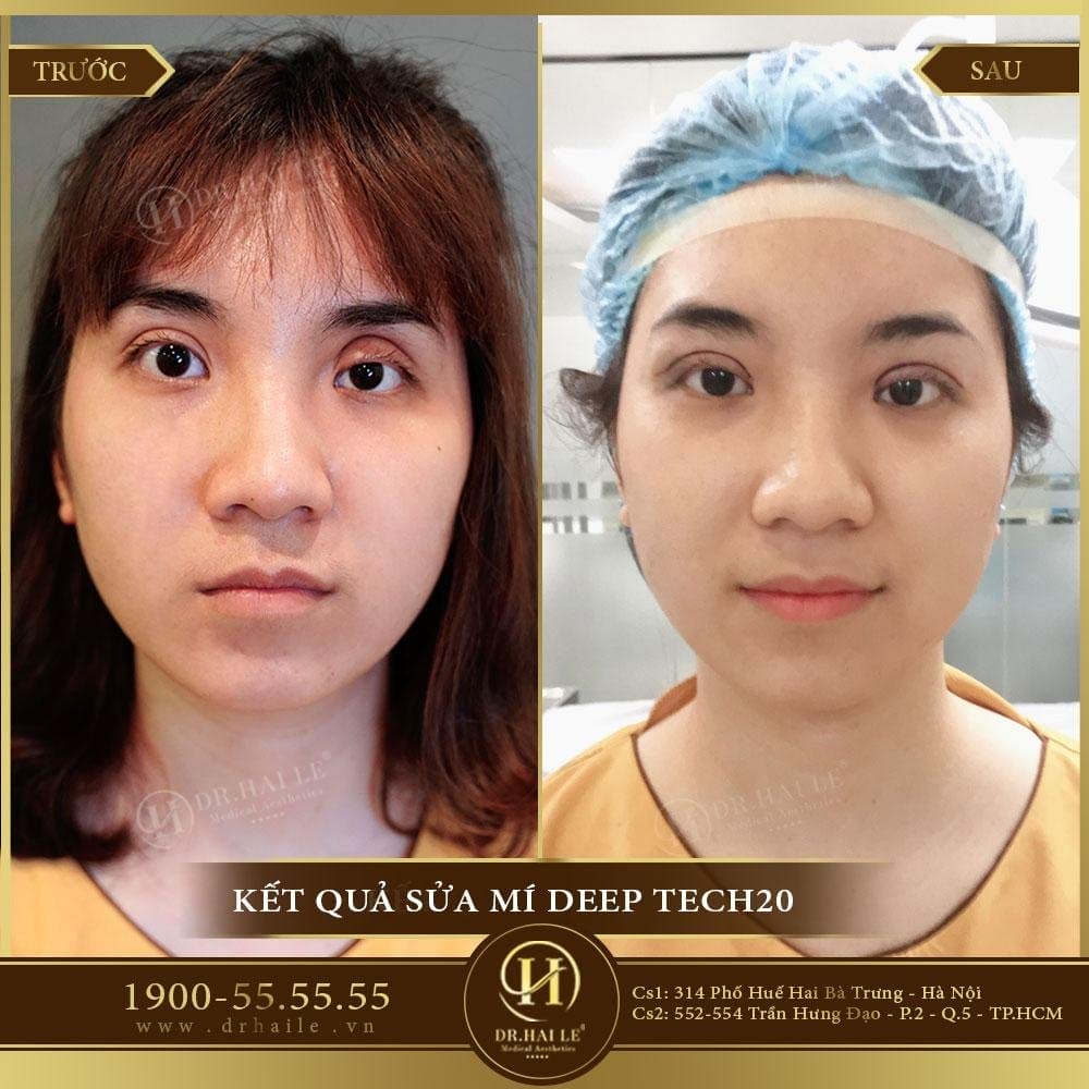 Dịch vụ cao cấp