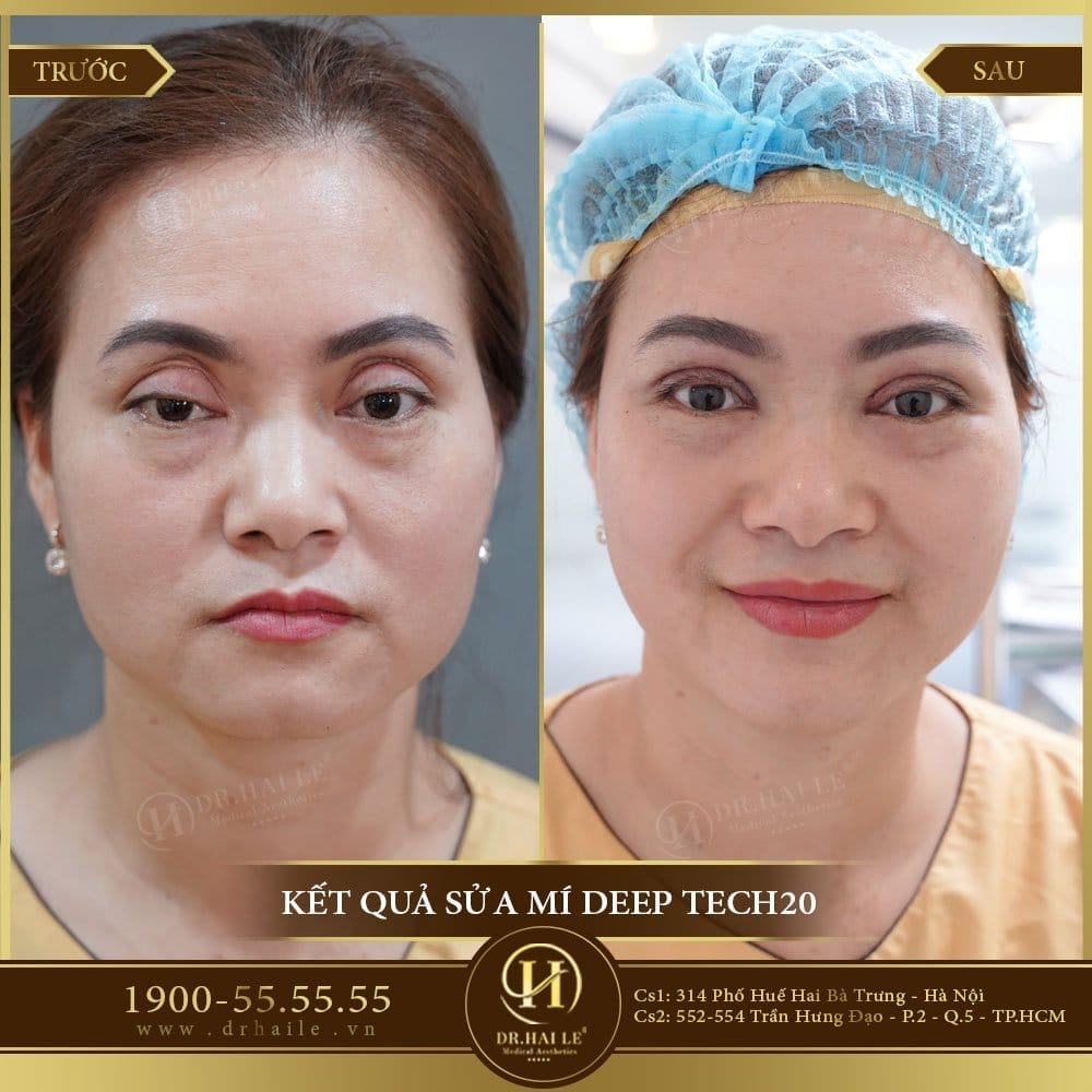 Dịch vụ cao cấp