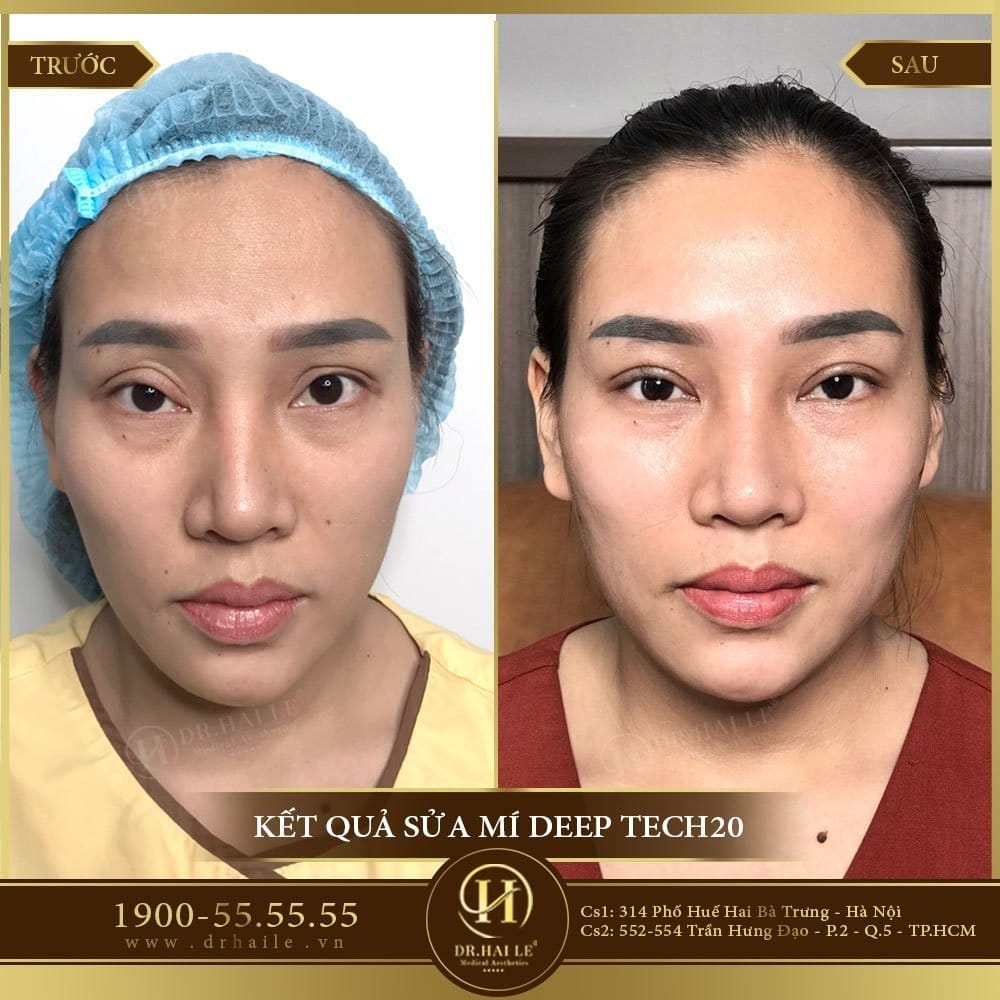 Dịch vụ cao cấp