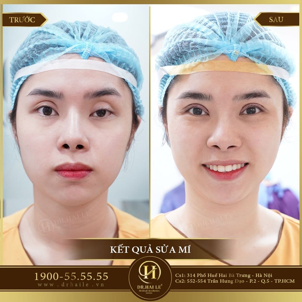Dịch vụ cao cấp