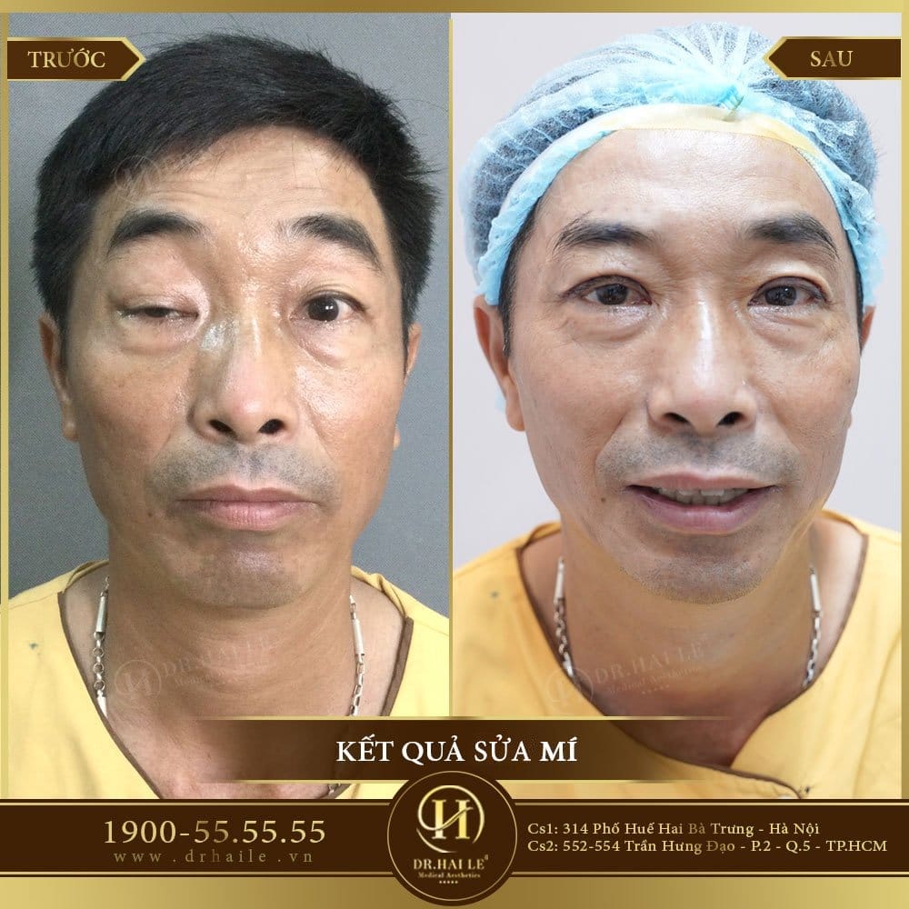 Dịch vụ cao cấp
