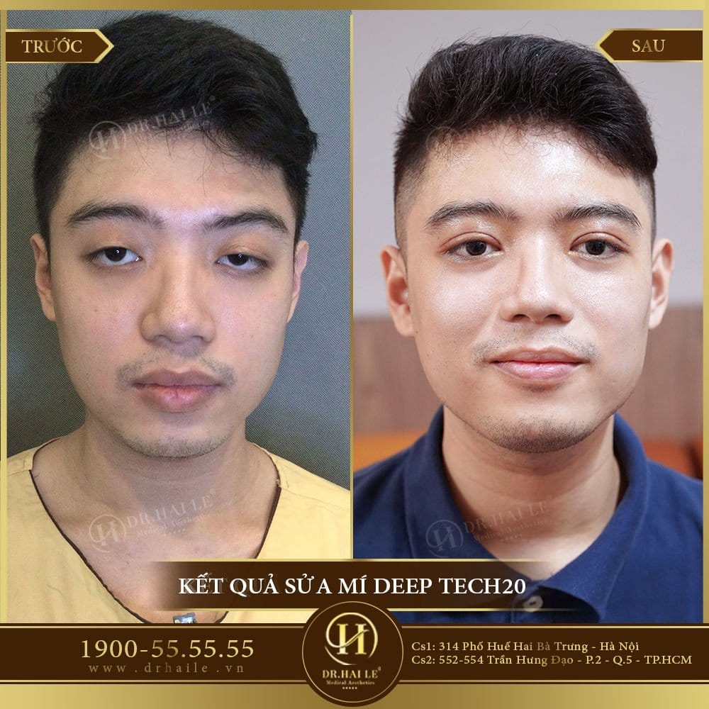 Dịch vụ cao cấp