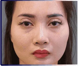 Demi 5D