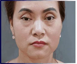 Demi 5D