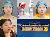 Sửa mí lỗi hỏng