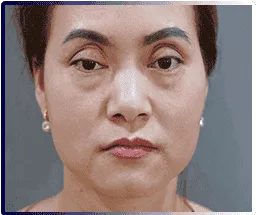 Demi 5D