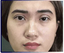 Demi 5D