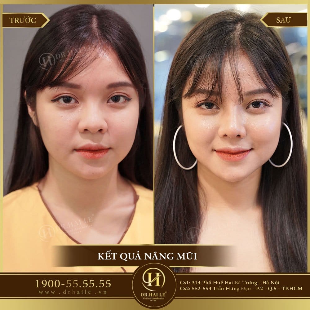 Dịch vụ cao cấp