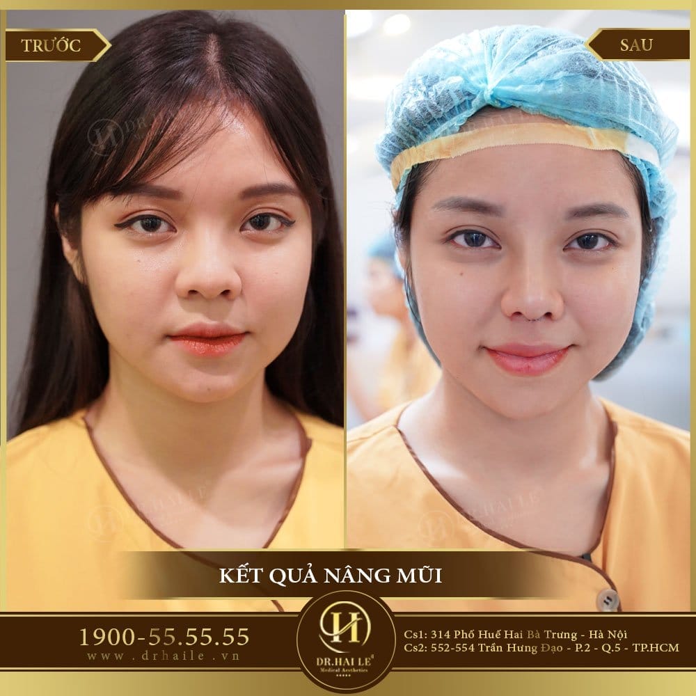 Dịch vụ cao cấp