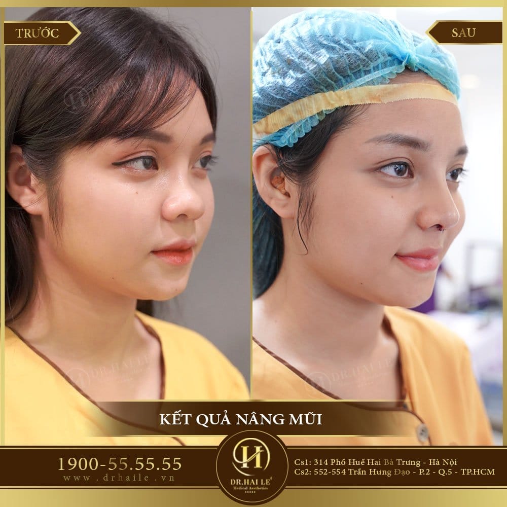 Dịch vụ cao cấp