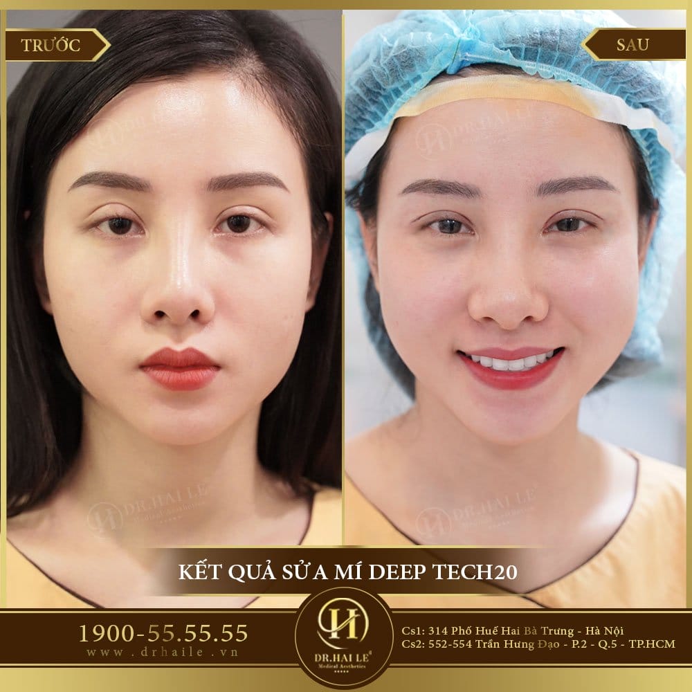 Dịch vụ cao cấp