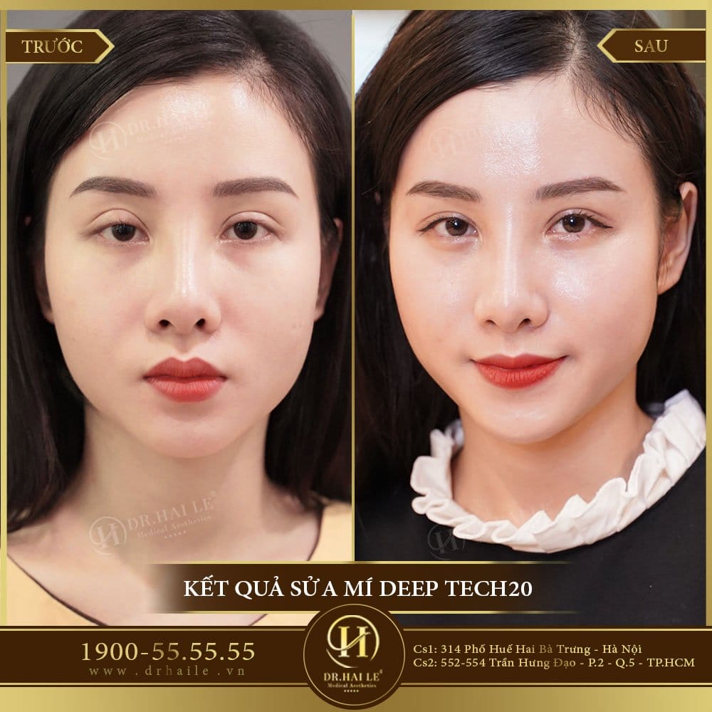 Dịch vụ cao cấp