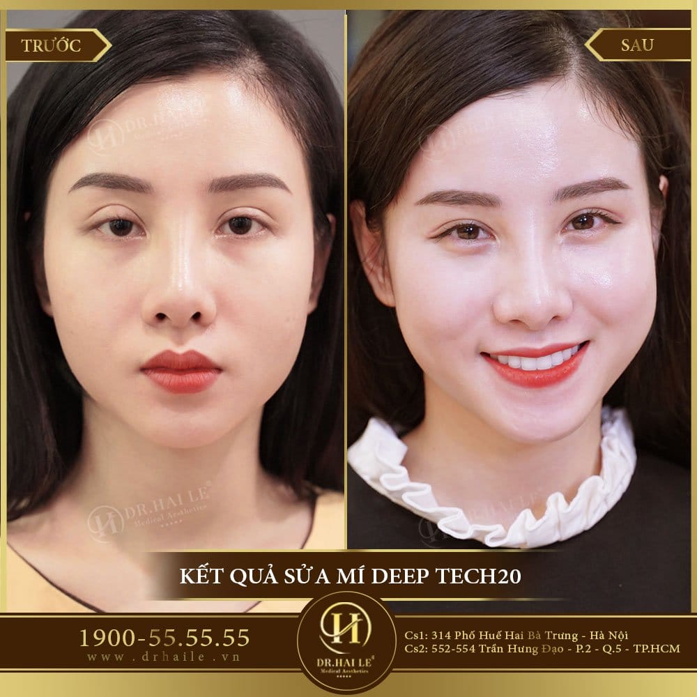 Dịch vụ cao cấp