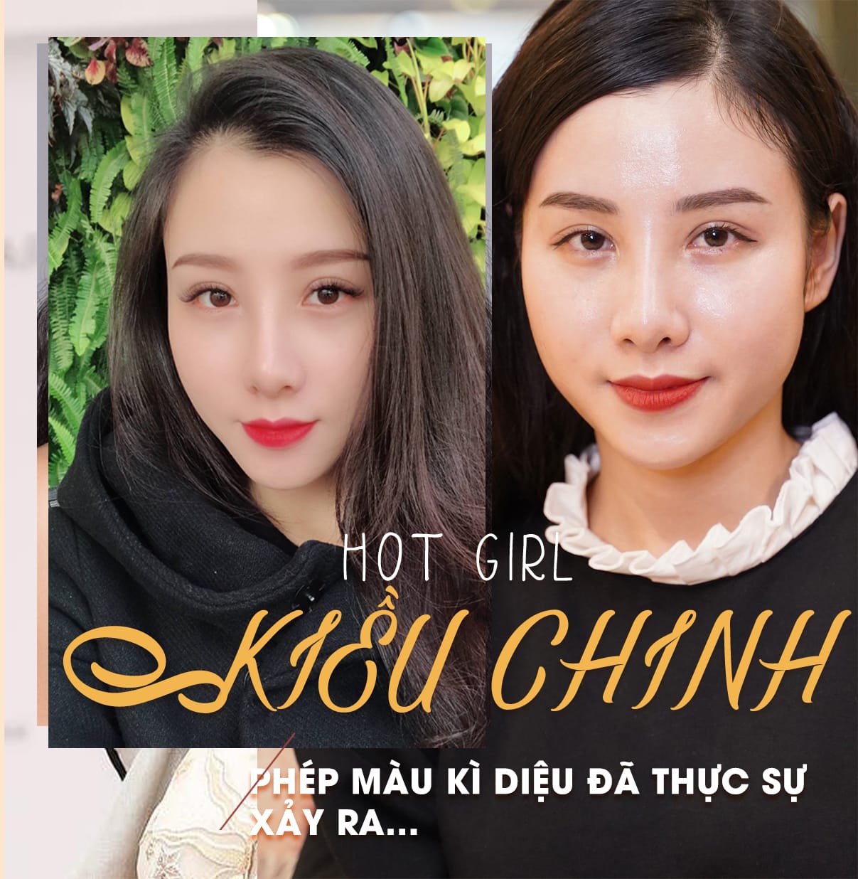 Dịch vụ cao cấp