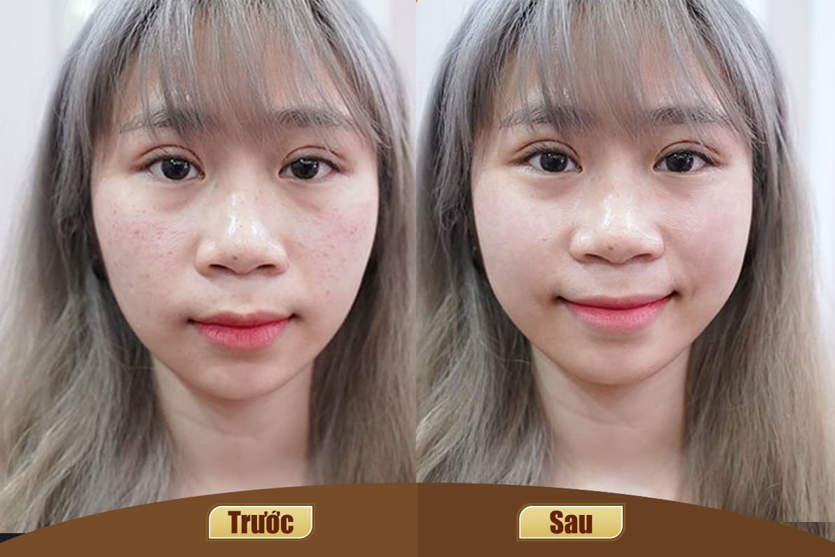 Dịch vụ cao cấp