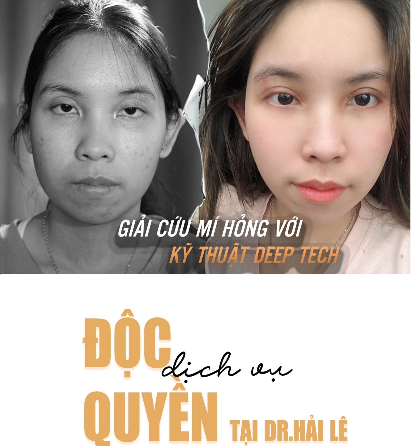 Dịch vụ cao cấp
