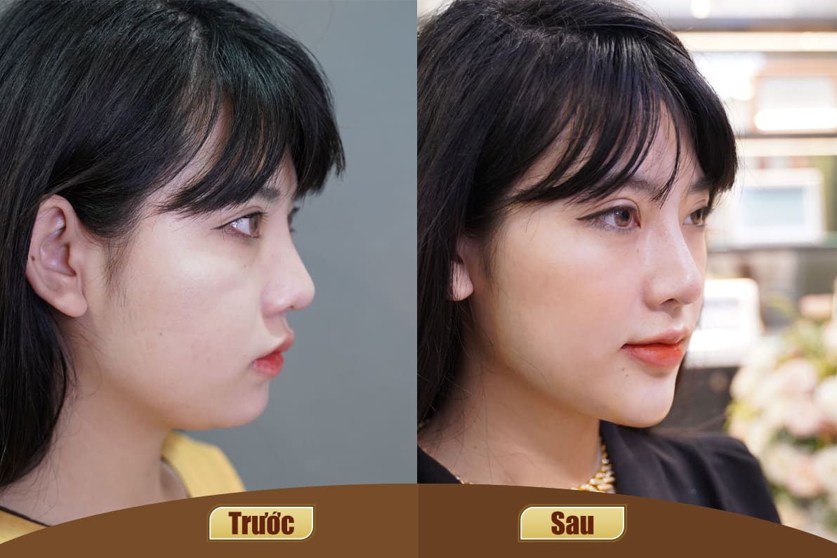 Dịch vụ cao cấp