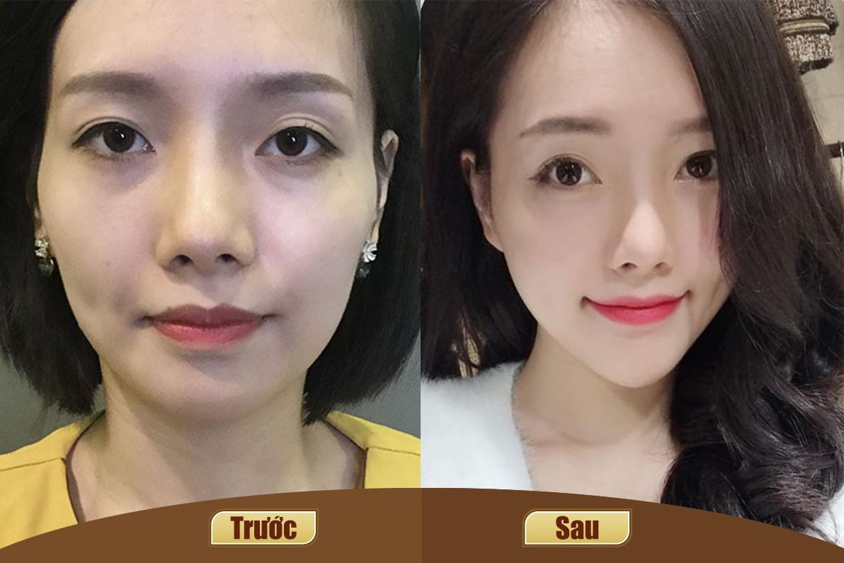 Dịch vụ cao cấp