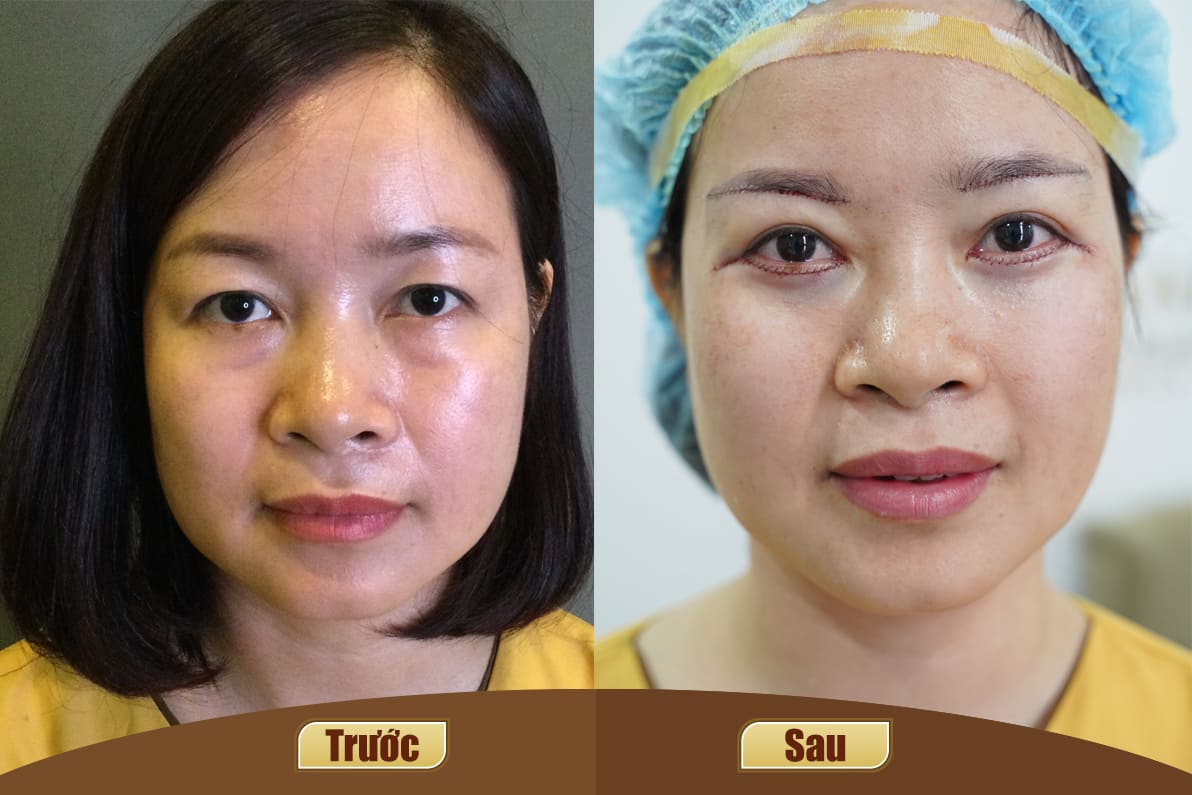 Dịch vụ cao cấp