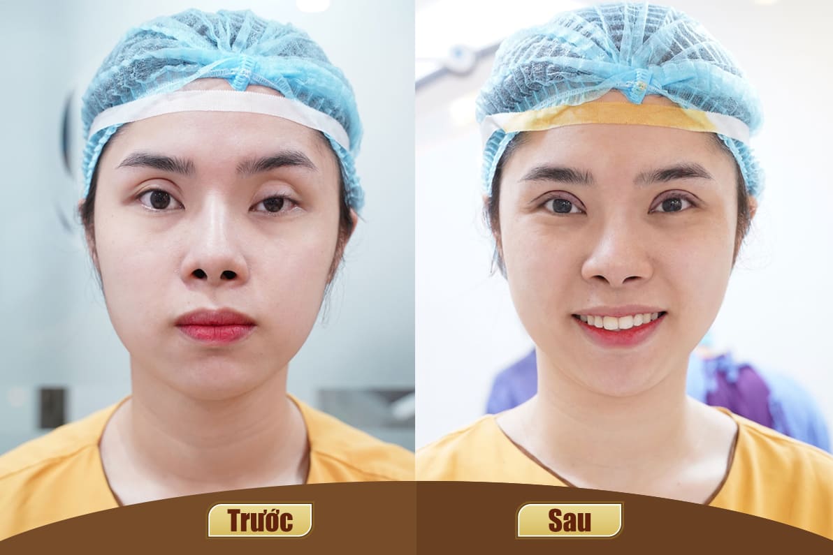 Dịch vụ cao cấp