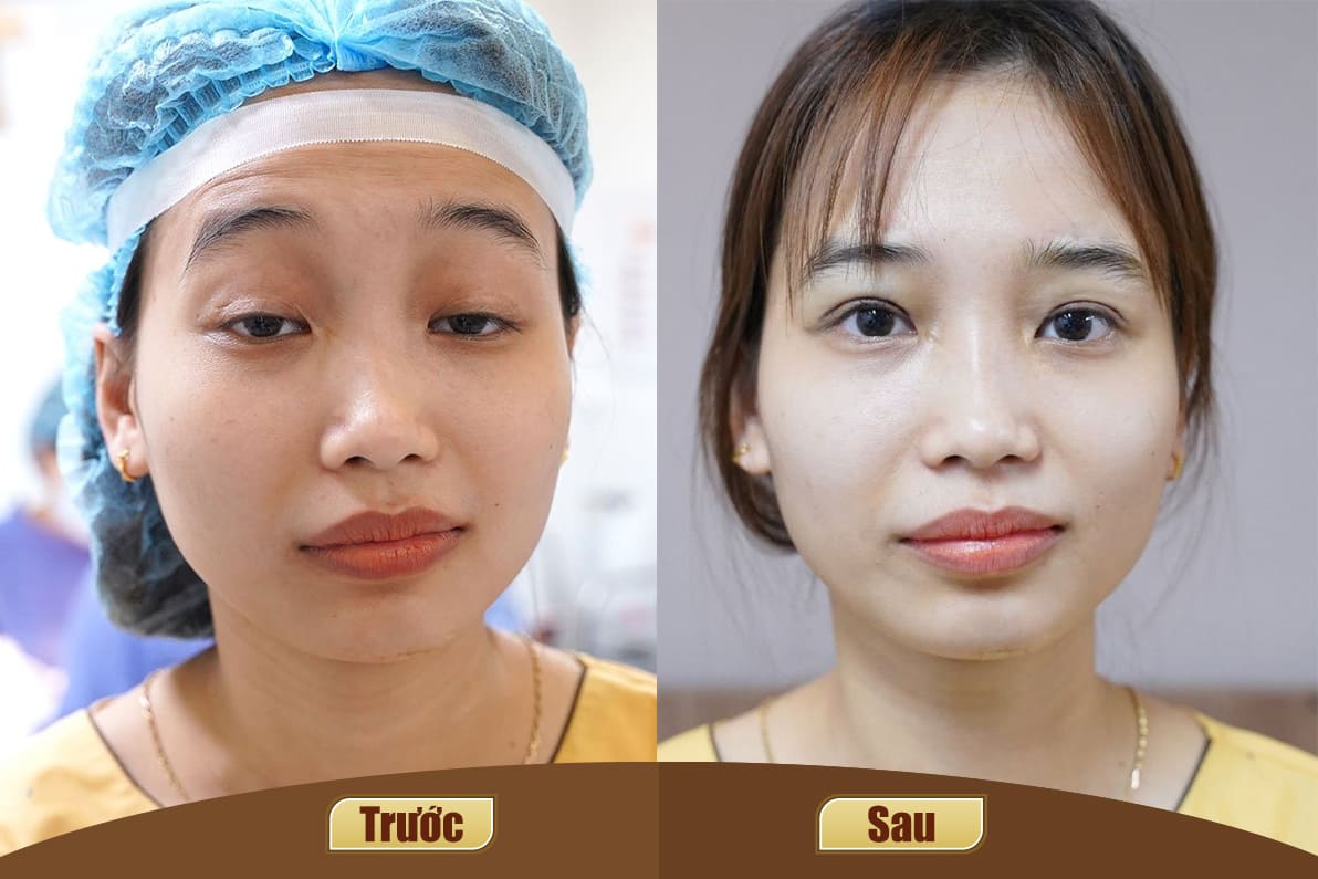 Dịch vụ cao cấp