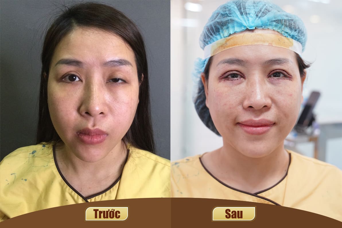 Dịch vụ cao cấp