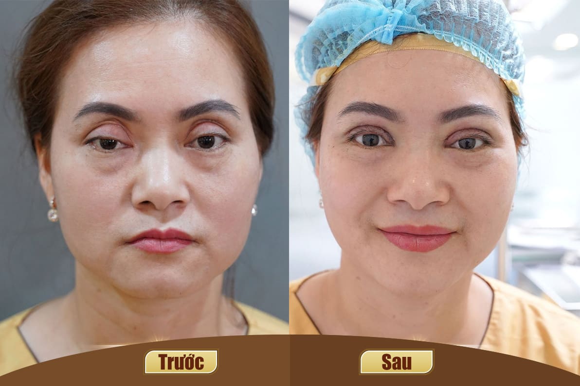 Dịch vụ cao cấp