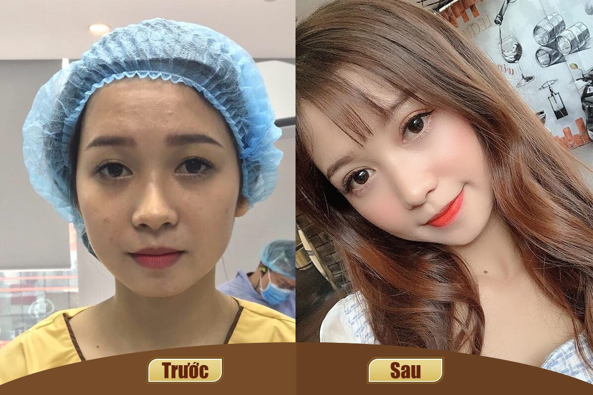 Dịch vụ cao cấp