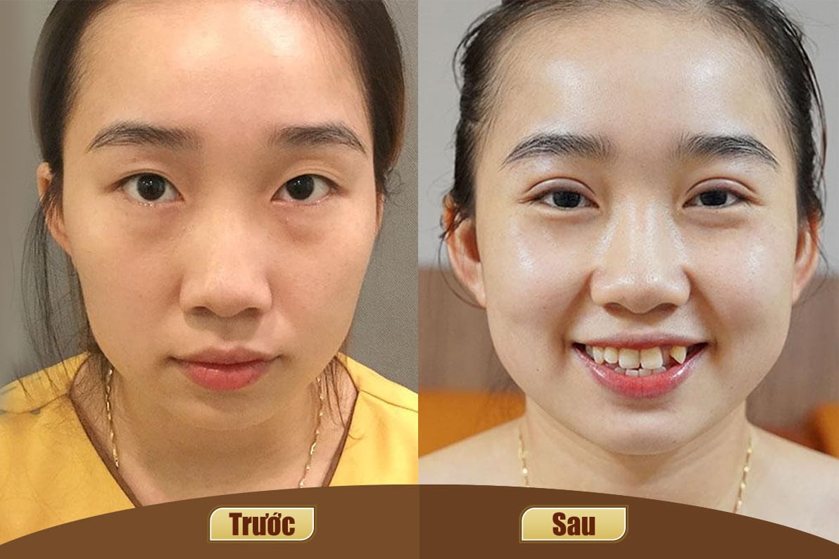 Dịch vụ cao cấp