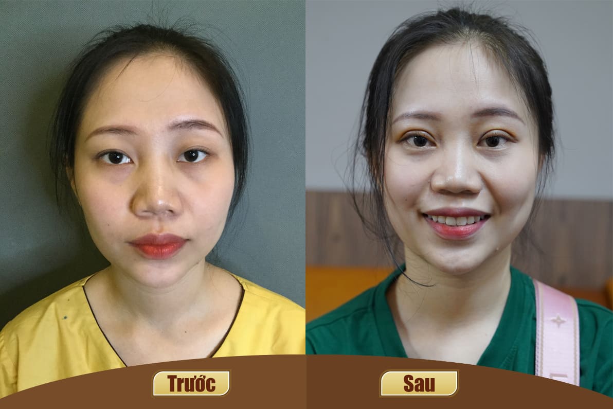 Dịch vụ cao cấp