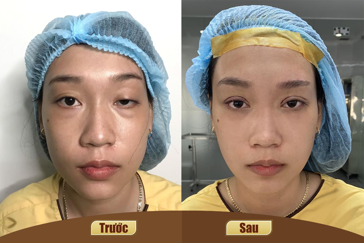 Dịch vụ cao cấp