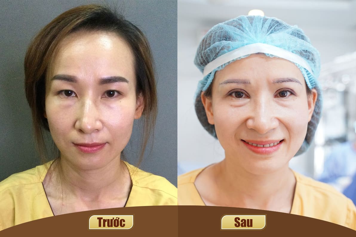 Dịch vụ cao cấp