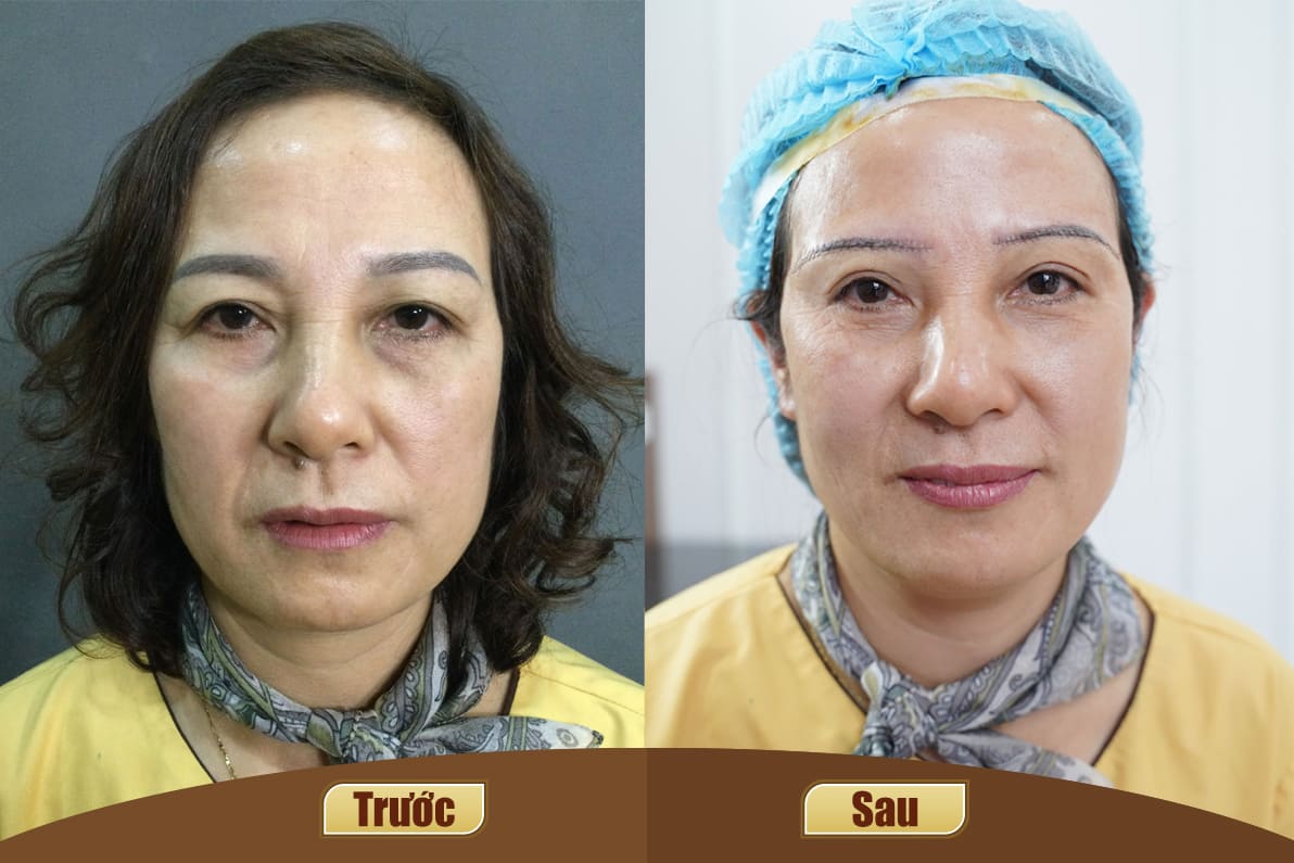 Dịch vụ cao cấp