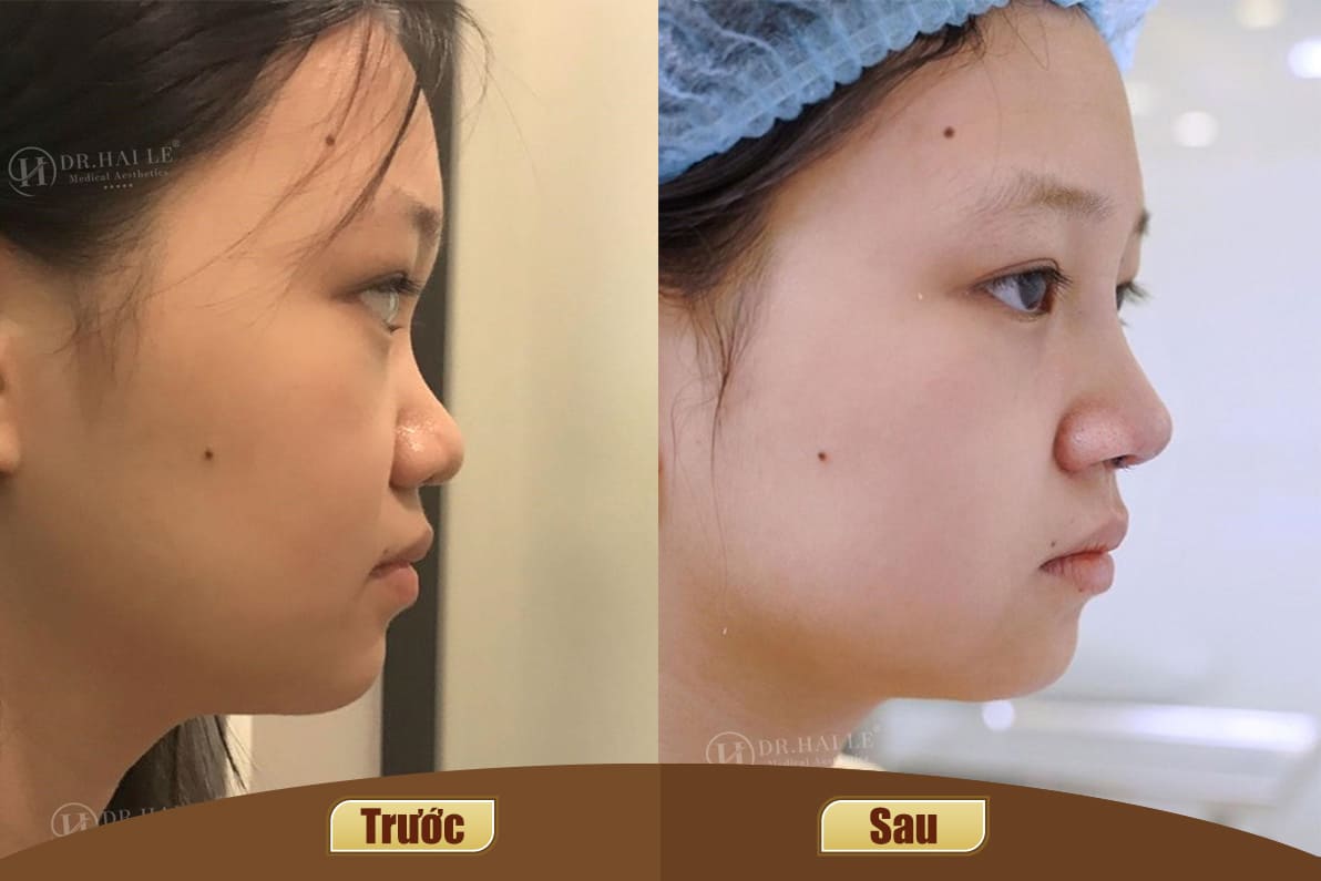 Dịch vụ cao cấp