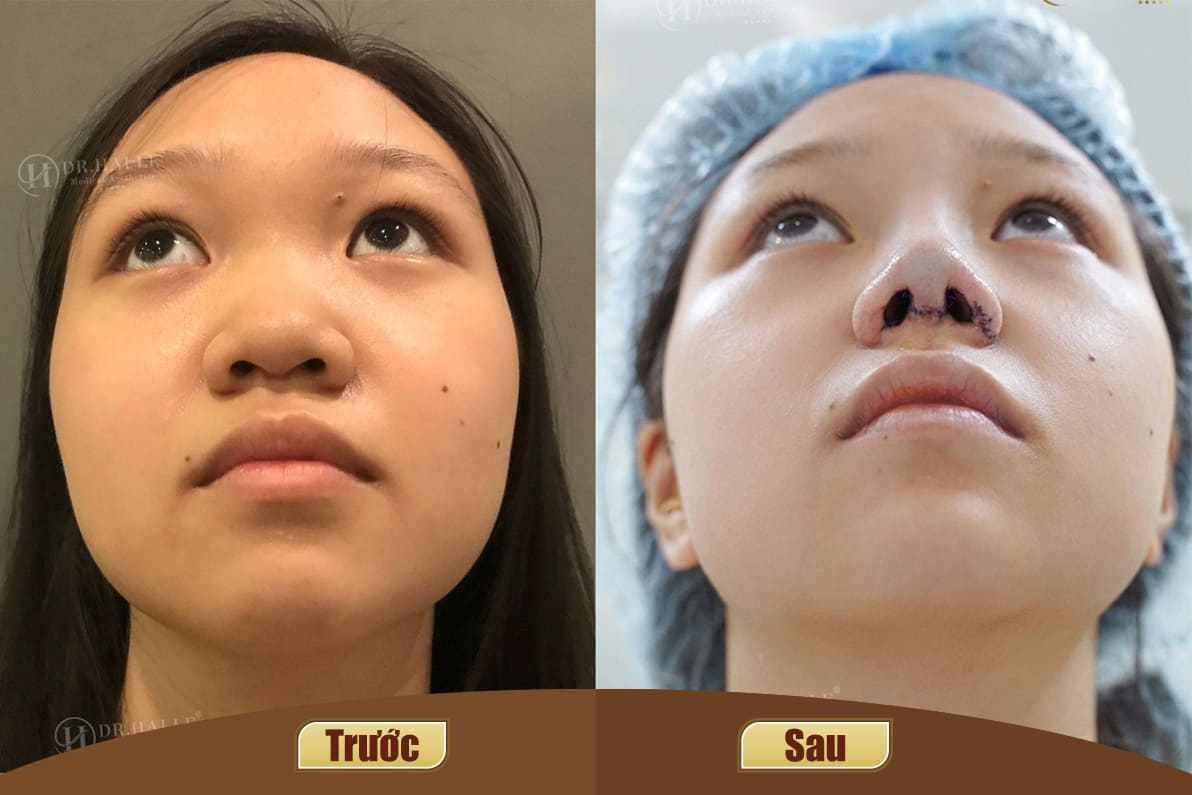 Dịch vụ cao cấp