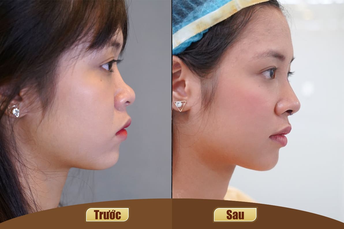 Dịch vụ cao cấp