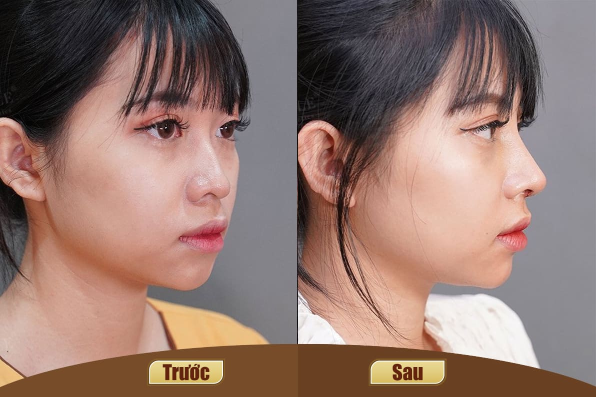 Dịch vụ cao cấp