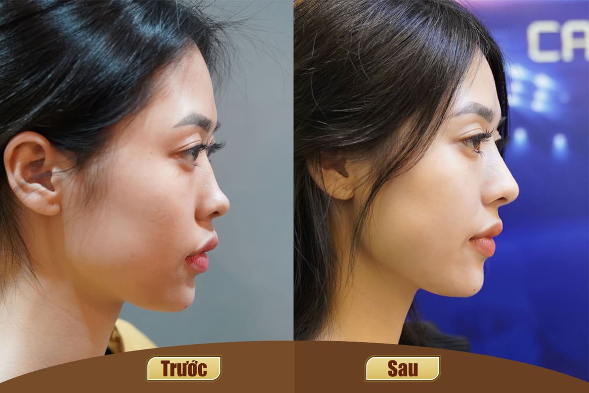 Dịch vụ cao cấp