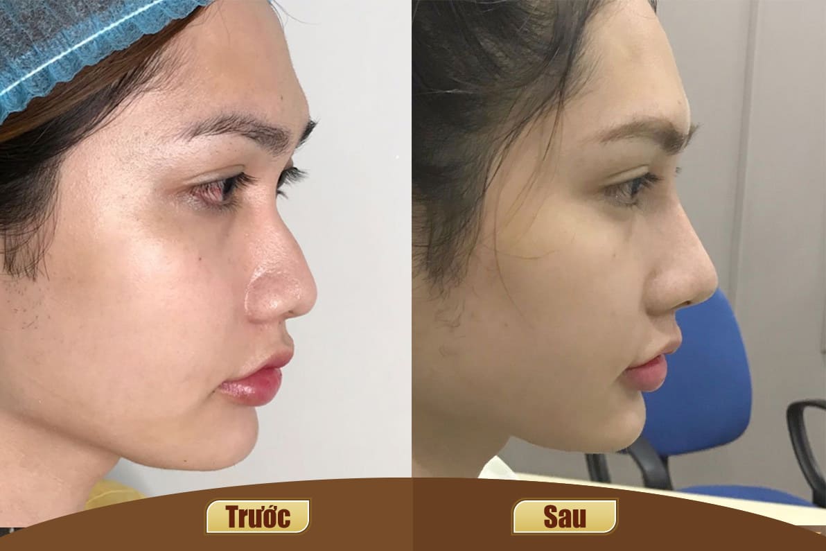 Dịch vụ cao cấp