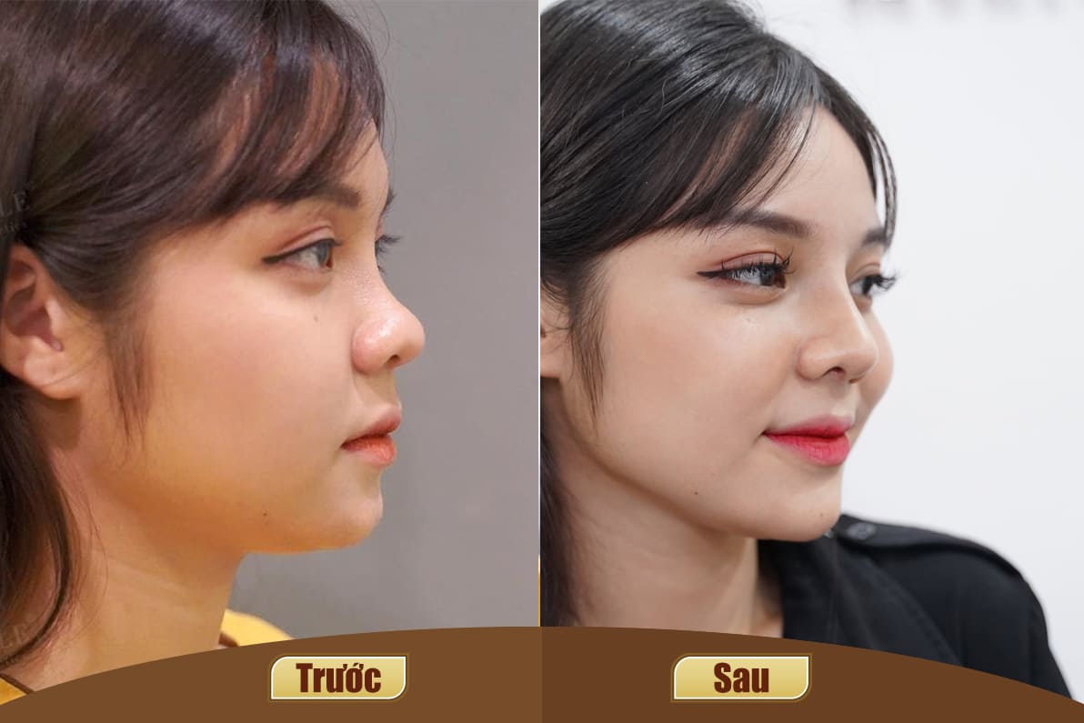 Dịch vụ cao cấp