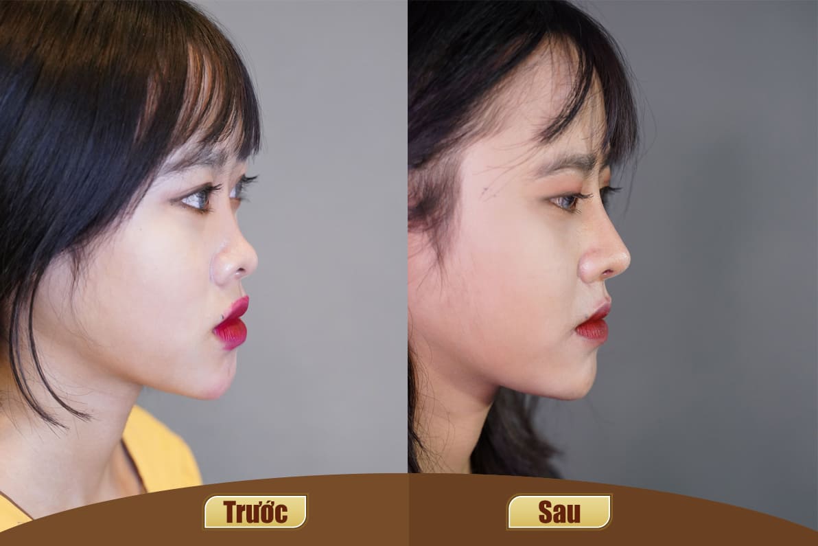 Dịch vụ cao cấp