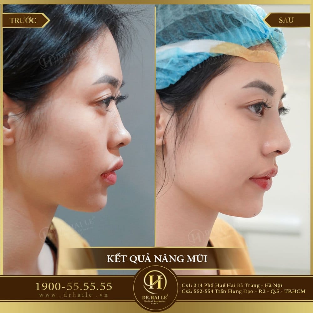 Dịch vụ cao cấp
