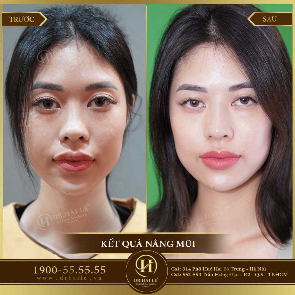 Dịch vụ cao cấp