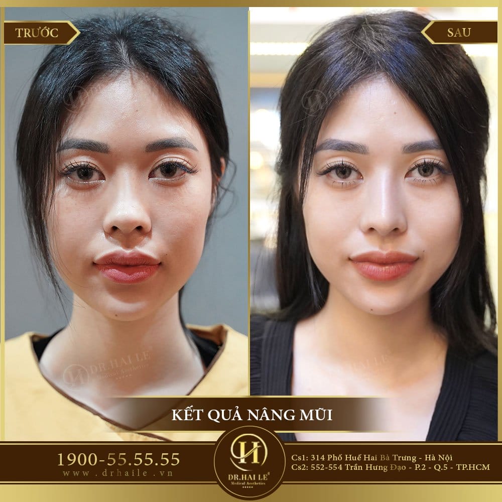 Dịch vụ cao cấp