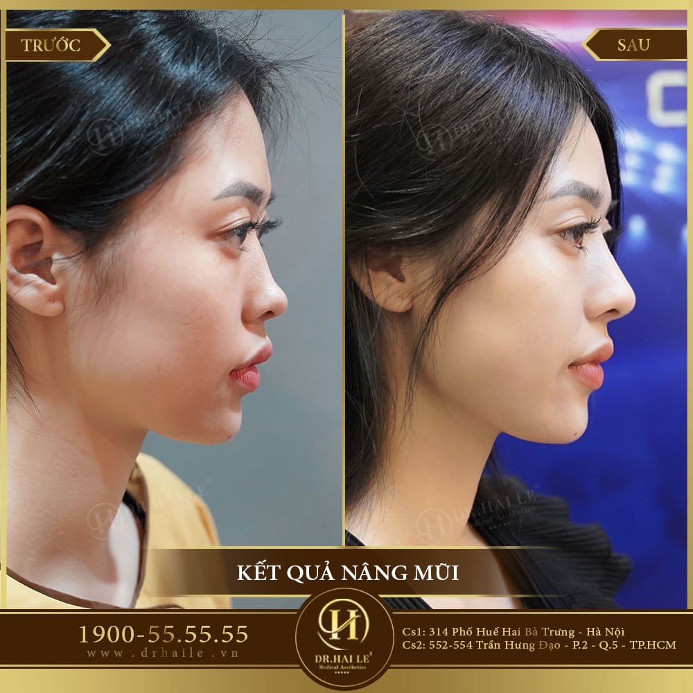 Dịch vụ cao cấp