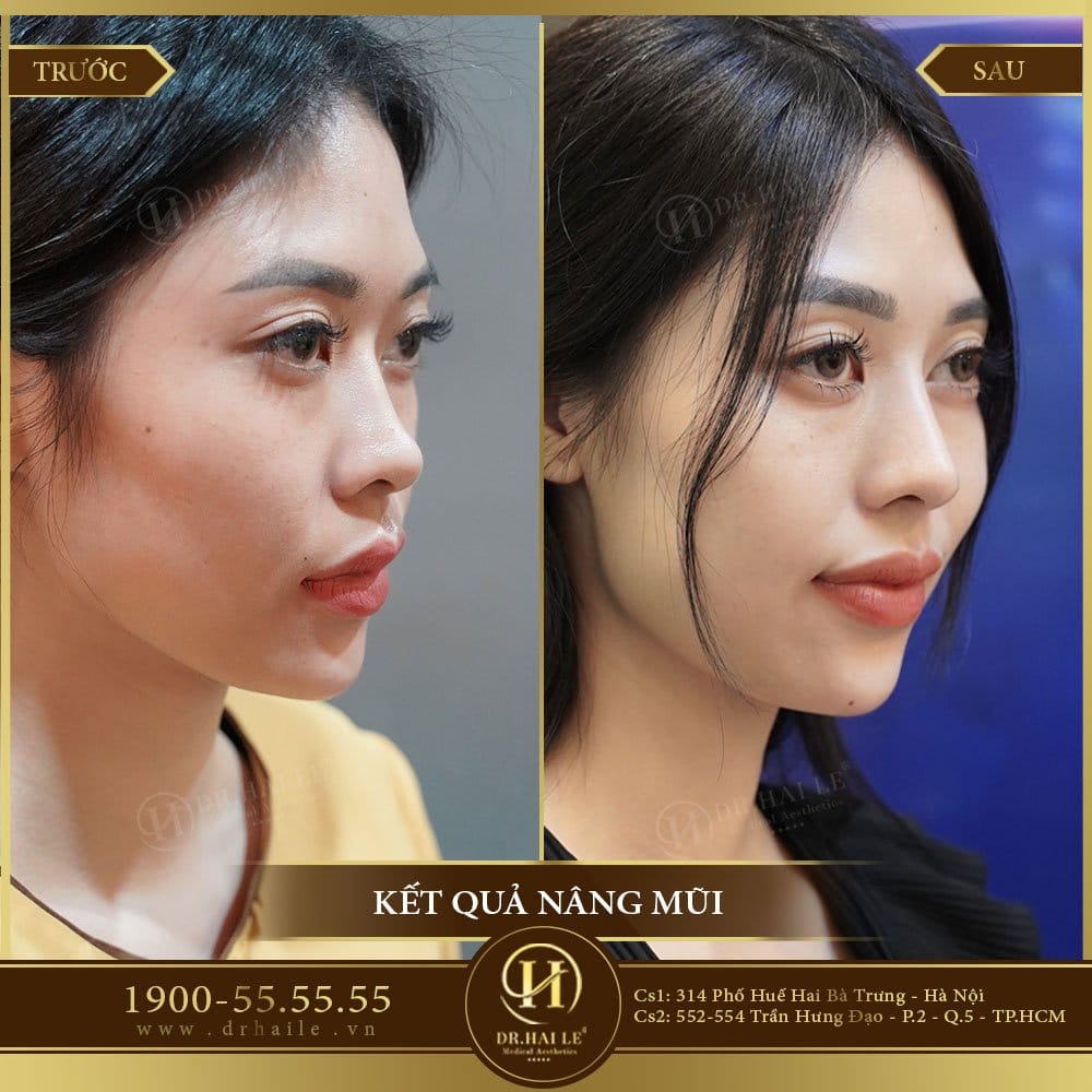 Dịch vụ cao cấp