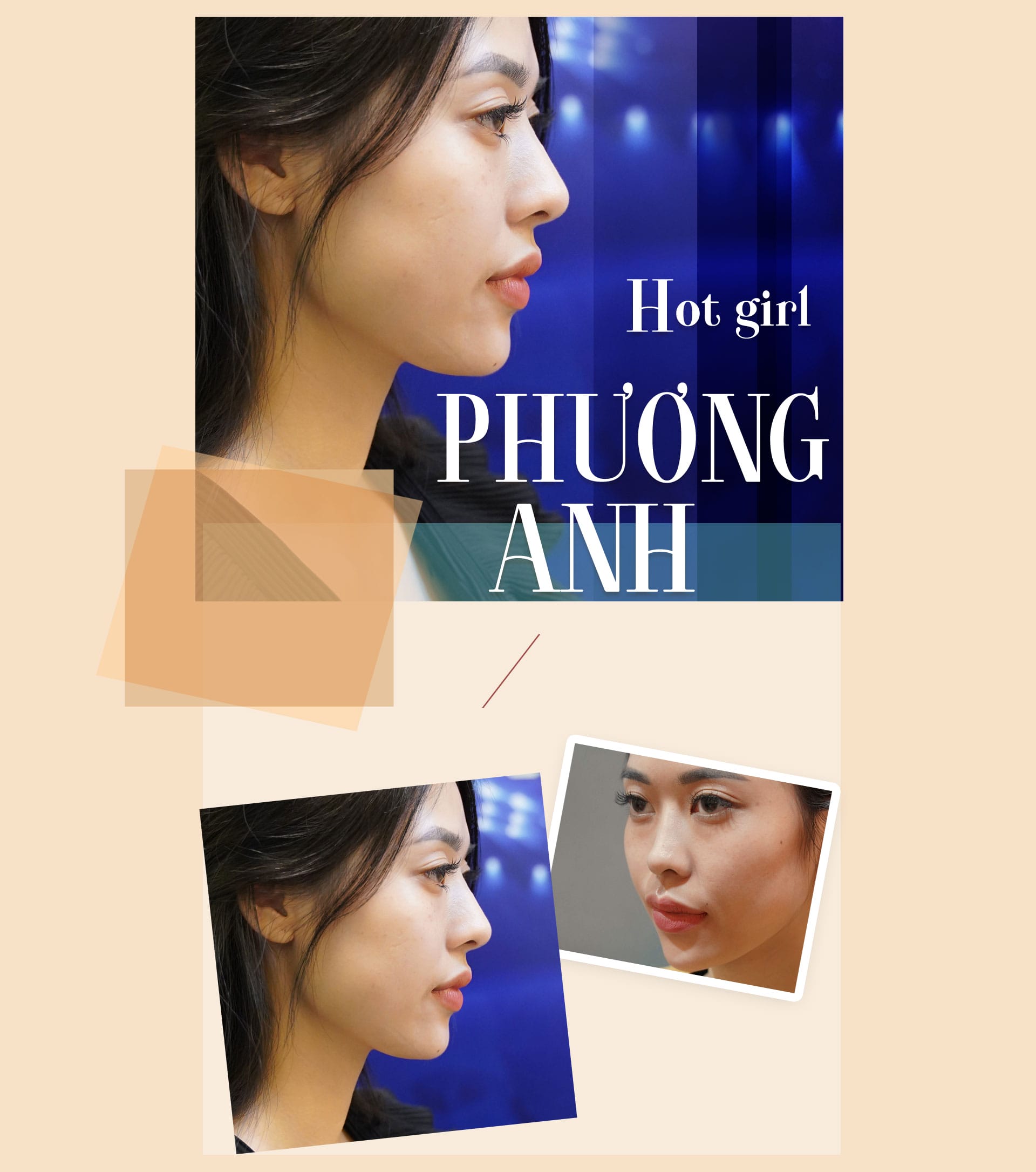 Dịch vụ cao cấp