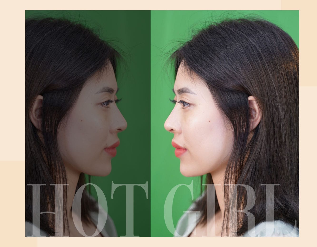 Dịch vụ cao cấp