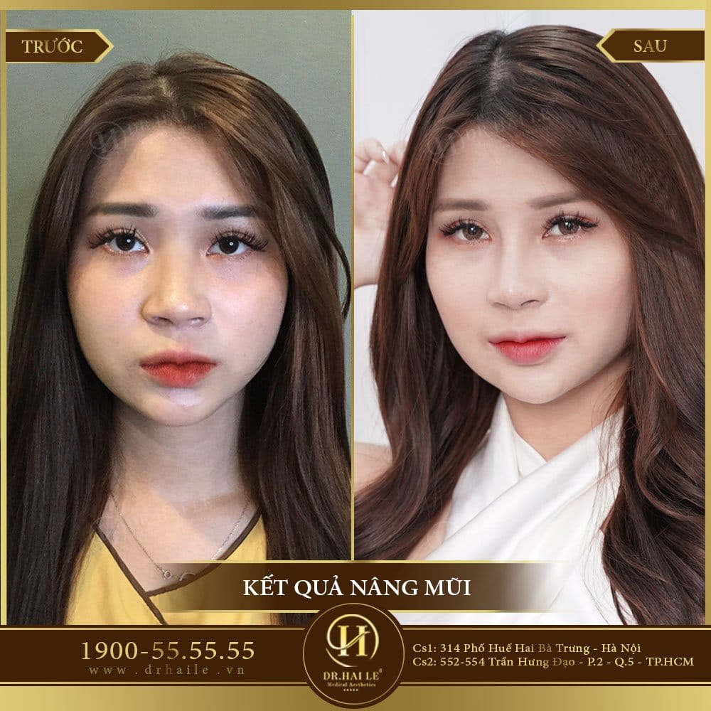 Dịch vụ cao cấp
